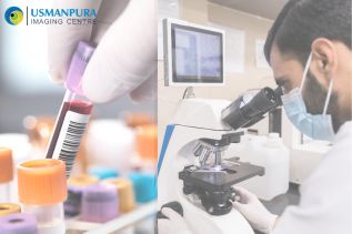The Best Pathology Lab in Ahmedabad for Precise Blood Test Reports