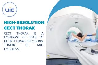 High-Resolution CECT Thorax: Accurate and Fast Diagnosis