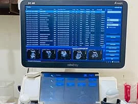 Sonography ultrasound imaging service in Ahmedabad