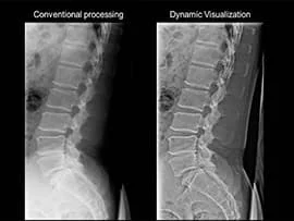 Digital X-Ray DR system at Usmanpura Imaging