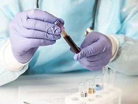 Blood test and pathology lab services in Ahmedabad