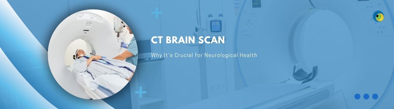 CT-Brain-Scan-for-Neurological-Health
