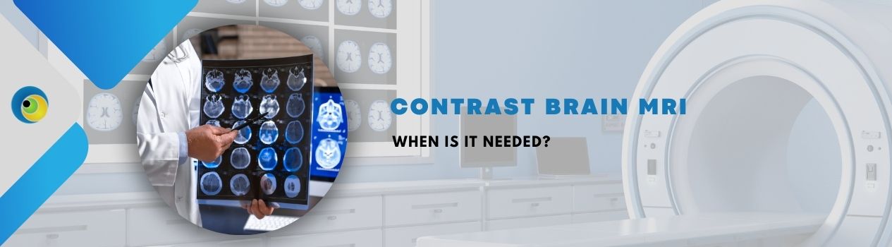 Contrast Brain MRI
