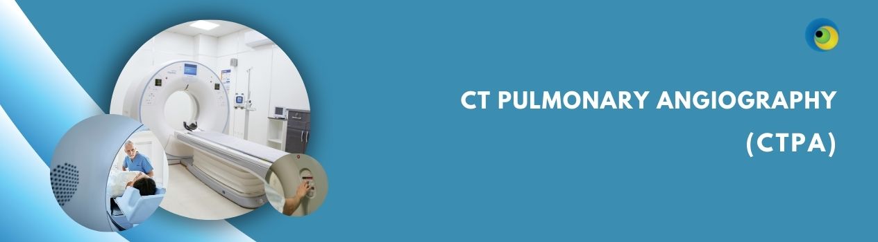 CT Pulmonary Angiography