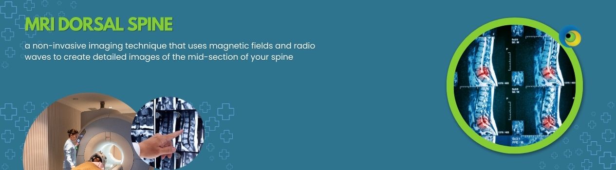 MRI DORSAL SPINE